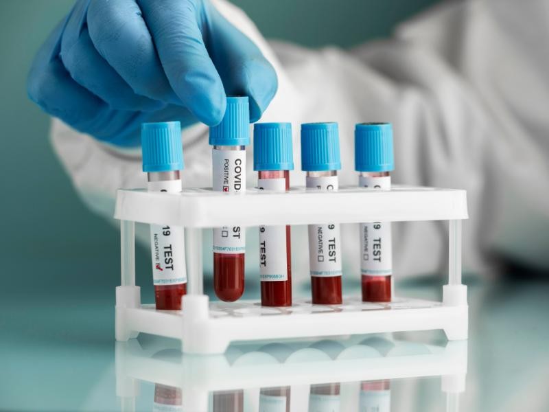 Fiz Exames de Sangue e me Disseram que meus Rins não estão Funcionando bem. O que Devo Fazer?