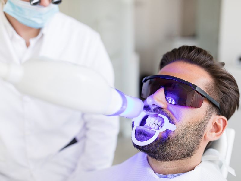 Clareamento Dental Funciona Mesmo? É Seguro?