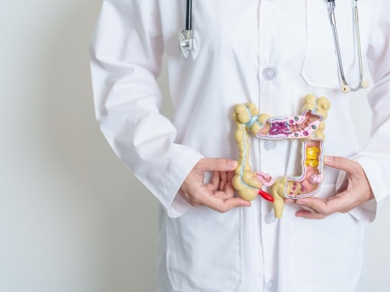 Há Alguma Estratégia para prevenir o Câncer de Intestino (Câncer Colorretal)?