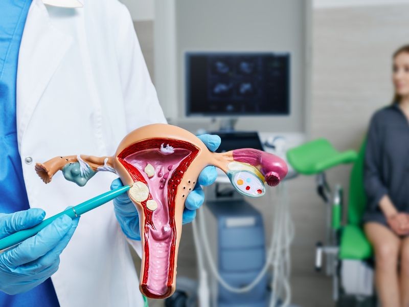Mioma Uterino: Sintomas e Tratamento