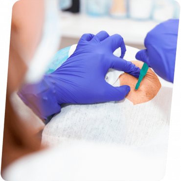 Biópsia em Cachoeirinha