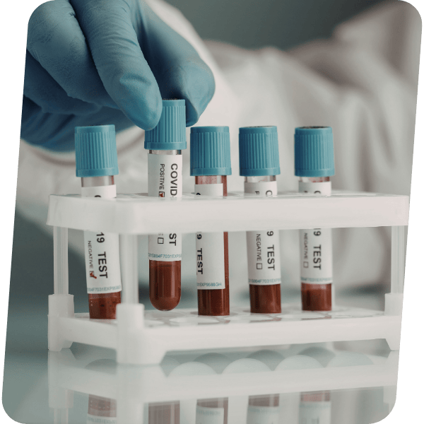 Exames de Sangue
