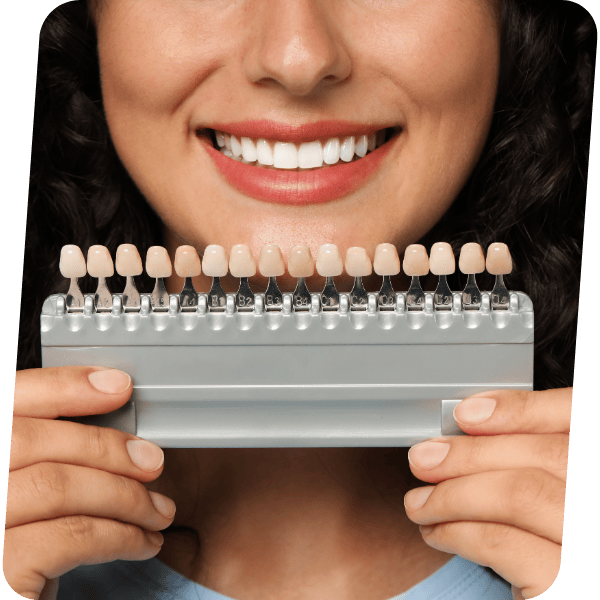 Facetas de Porcelana